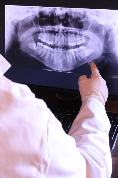 Best Emergency Denture Repair in Woodbury, NJ