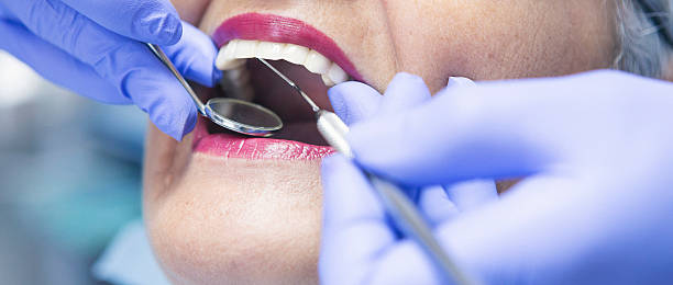 Best Knocked-Out Tooth (Avulsed Tooth) Treatment in Woodbury, NJ